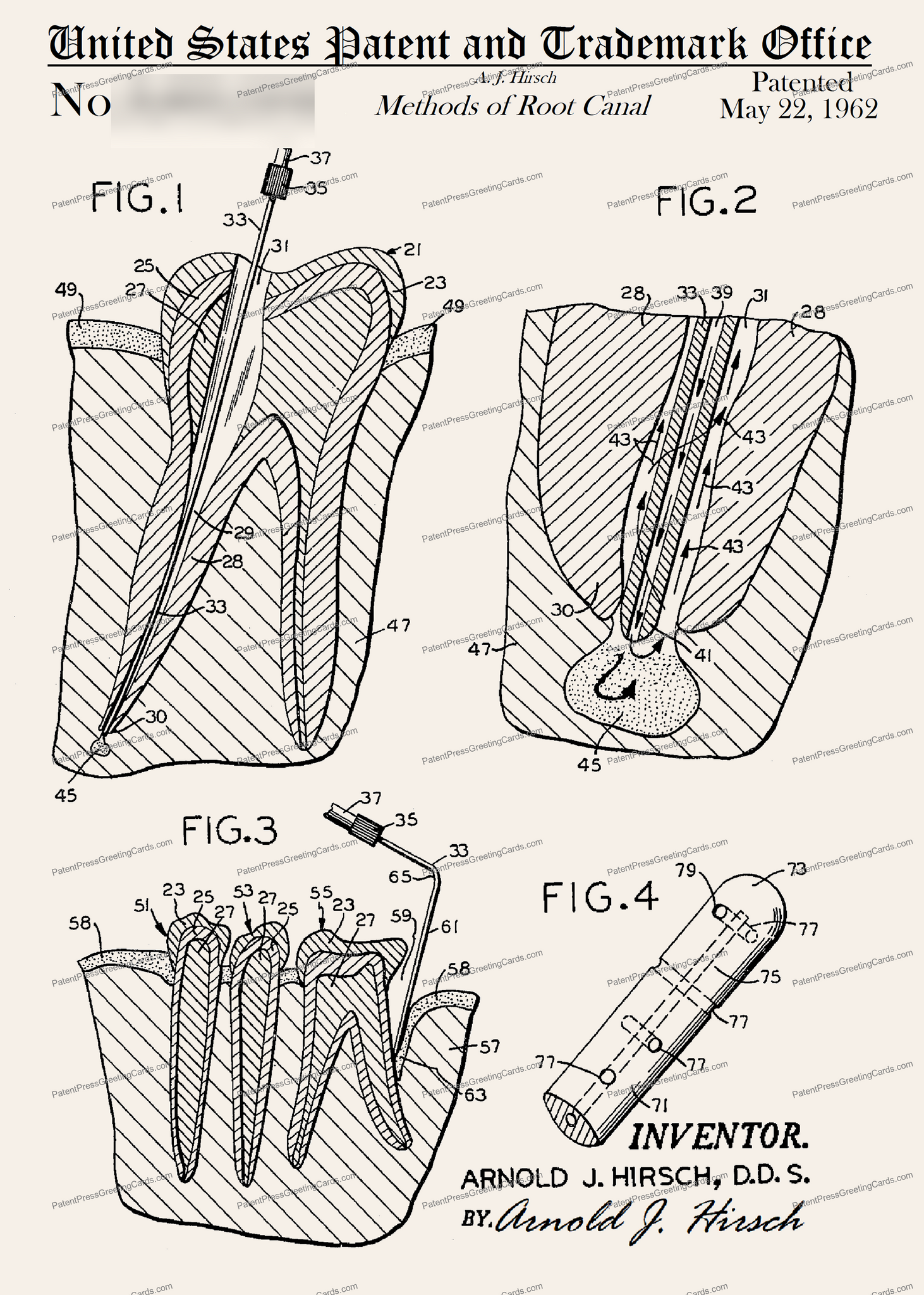 CARD-228: Root Canal - Patent Press™